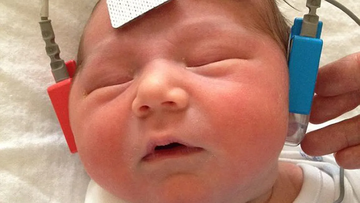 Imaginile emoţionante care au făcut ÎNCONJURUL LUMII: Un bebeluş de 7 săptămâni AUDE pentru PRIMA DATĂ