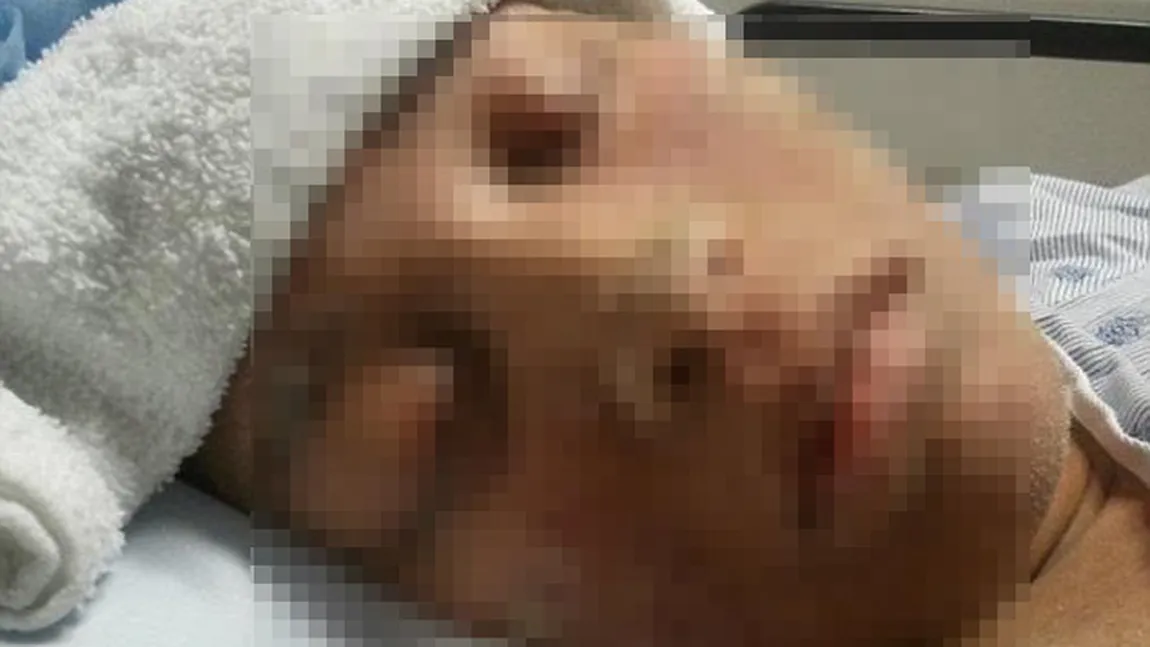 DOCTORII au RĂMAS MASCĂ: SINGURA femeie din lume căreia în creşte ASTA în loc de păr pe tot corpul VIDEO
