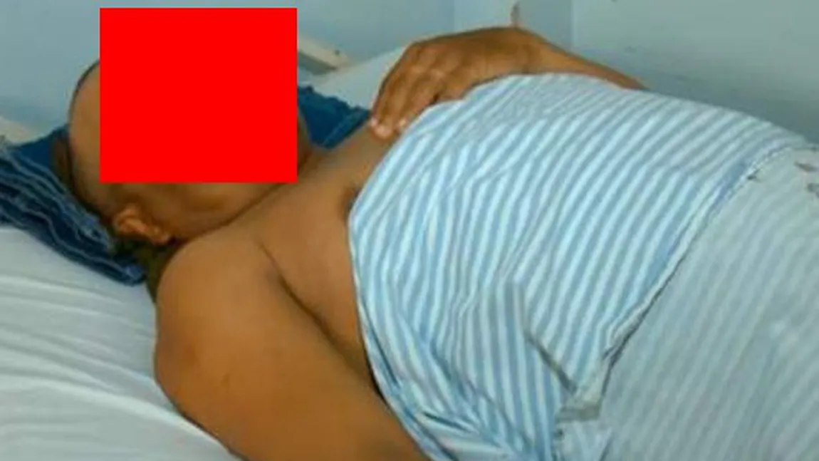 Medicii au fost ŞOCAŢI când au vazut în ce stare a condus un bărbat timp de doua ore până la SPITAL FOTO