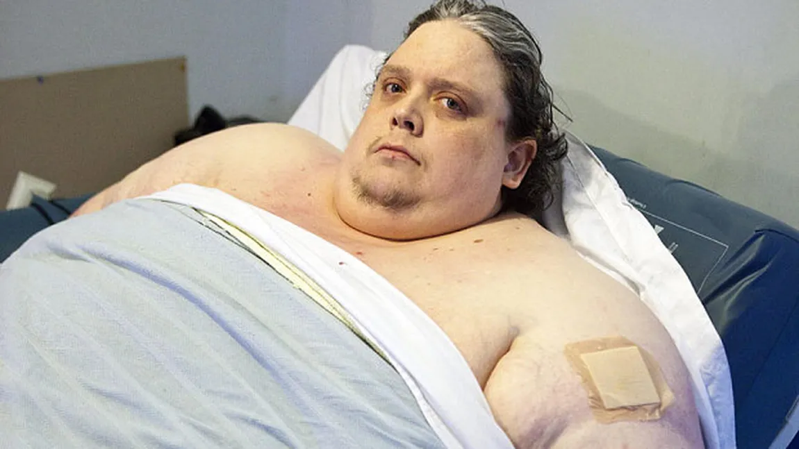 A murit cel mai gras om din lume. Mânca 22.000 de calorii pe zi