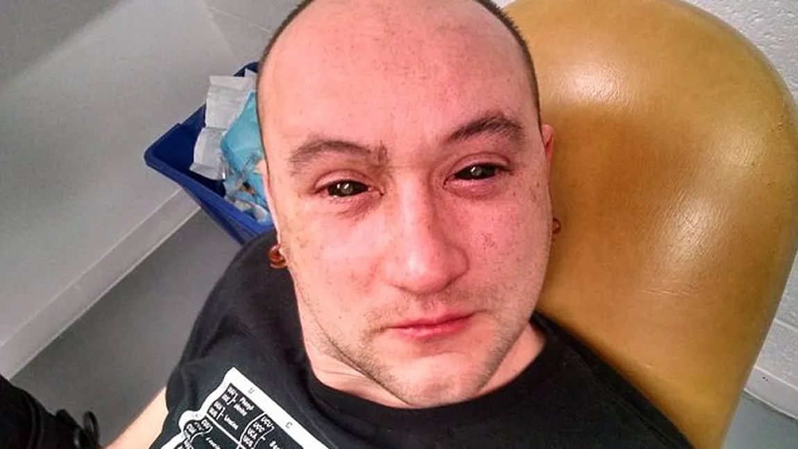 EXPERIMENT INCREDIBIL. Au fost invetate picăturile de ochi care te ajută să vezi în întuneric FOTO
