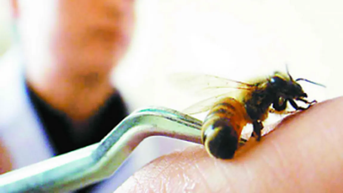 Apiterapia, tratamentul cu venin de albine
