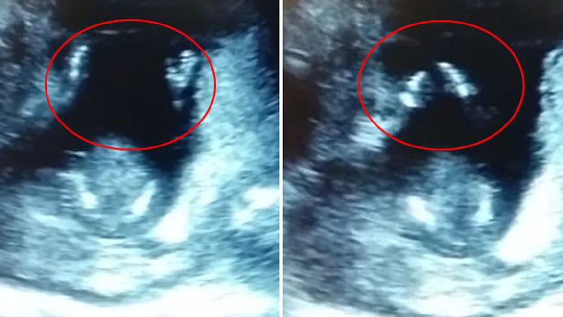 Un bebeluş nenăscut bate din palme în PÂNTECE în timp ce mama sa îi cântă VIDEO