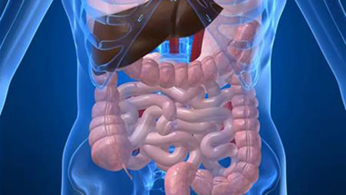 OBICEIURI care distrug intestinele