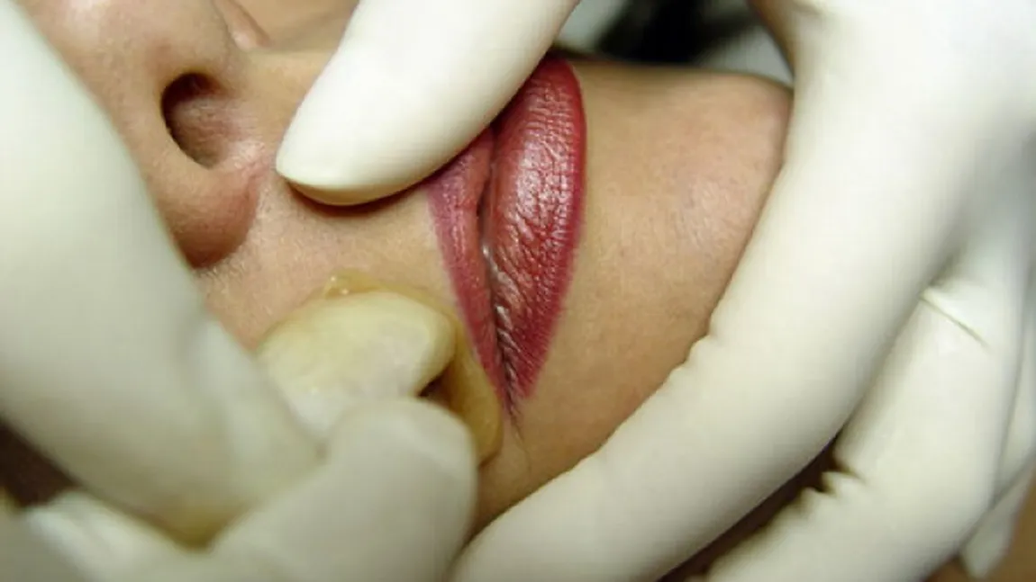 Soluţia NATURALĂ care te scapă de părul facial FĂRĂ DURERE