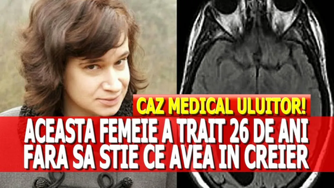 Această femeie a trăit până la 26 de ani fără să ştie ce are în creier