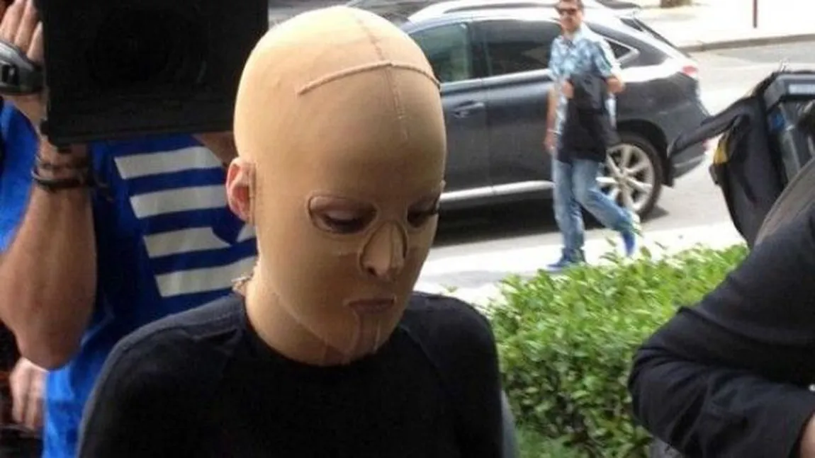 A purtat trei ani o mască, însă acum merge pe stradă fără ea. Cum arată femeia după ce a fost incendiată FOTO