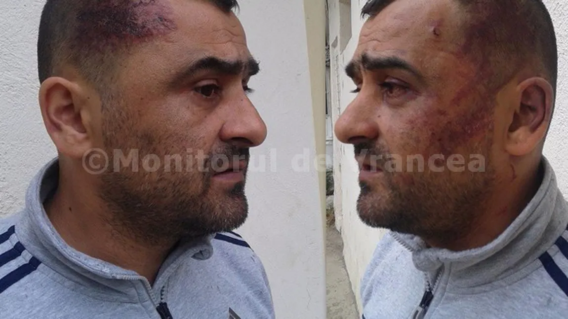 Antrenor de fotbal, bătut şi tâlhărit la Focşani. El şi jucătorii au fost atacaţi cu bastoane telescopice