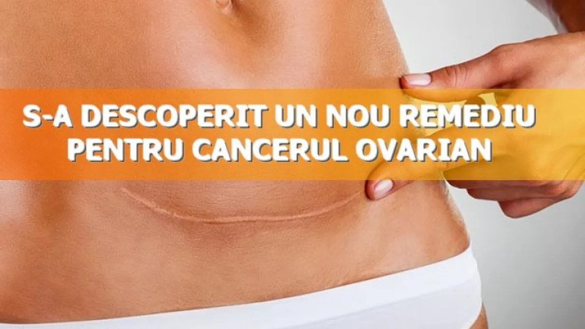 S-a descoperit un nou remediu pentru cancerul ovarian