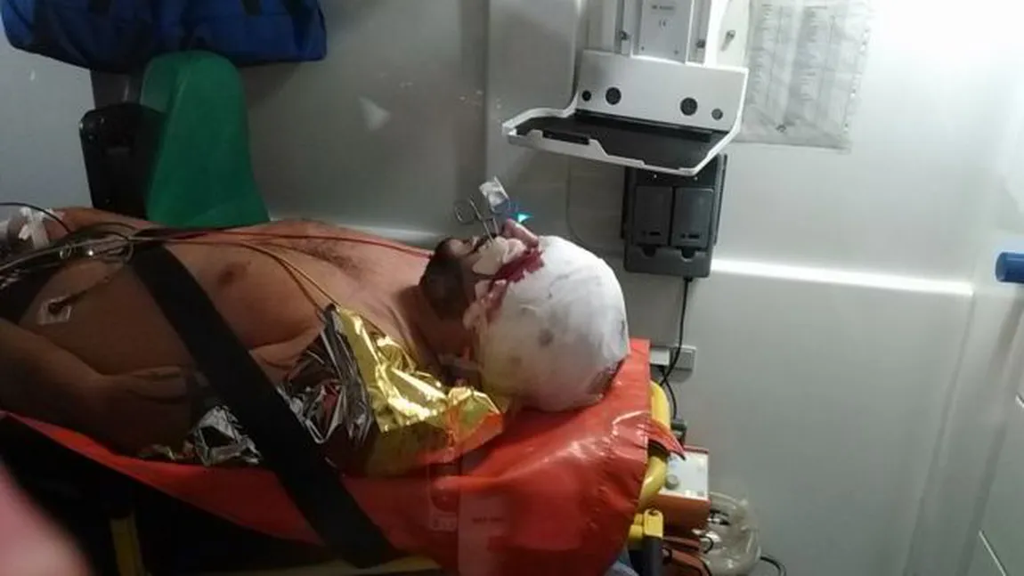 Scandal monstru între interlopi: O tânără a fost tunsă cu sabia şi desfigurată VIDEO