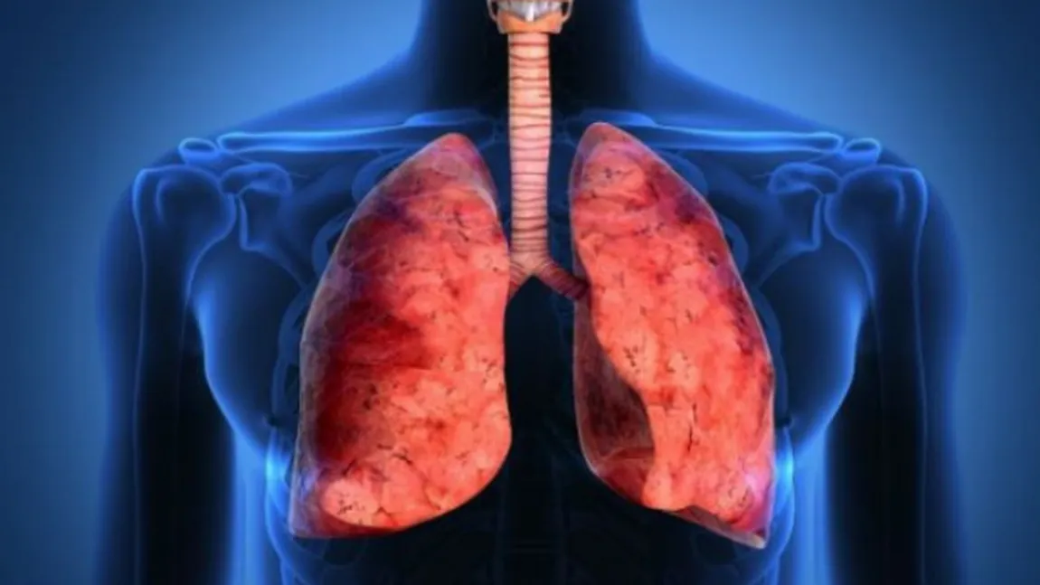 Atenţie fumători! Semnul BANAL care te ajută să depistezi CANCERUL pulmonar în stadiul INCIPIENT