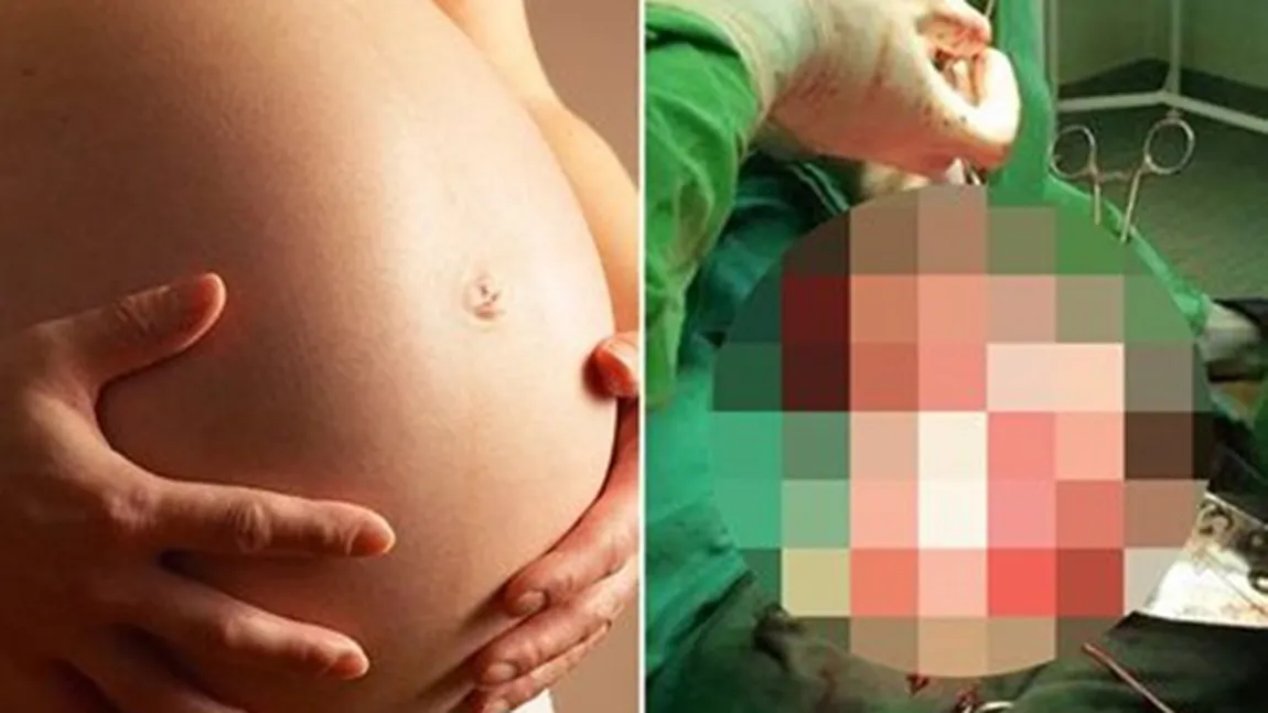 O femeie a crezut că este însărcinată, dar a fost devastată după ce a văzut că bebeluşul ei era altceva
