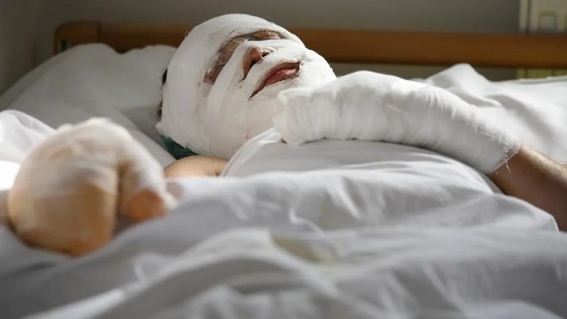 Care este starea de sănătate a bărbatului rănit grav în explozia de la Piatra Neamţ. Anunţul ministrului Sănătăţii