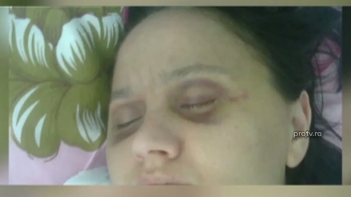O femeie din Timiş a fost bătută crunt de iubitul cunoscut pe internet