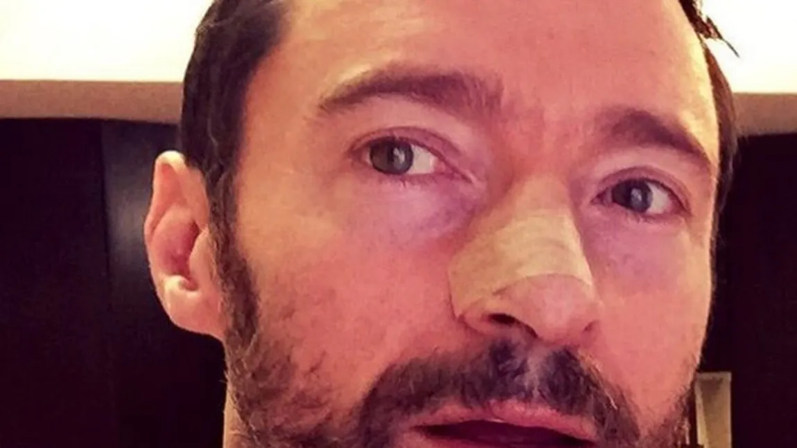 Hugh Jackman a învins din nou cancerul. Ce sfaturi le dă celebrul actor fanilor