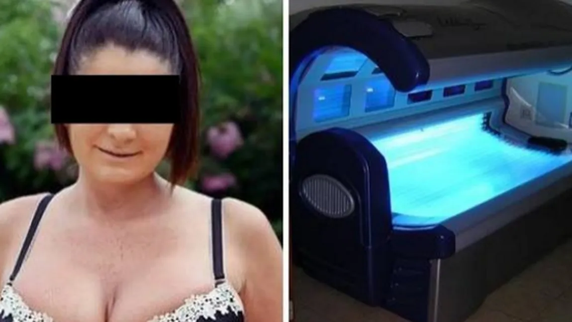 A stat 32 de minute la solar şi din model a ajuns un monstru FOTO