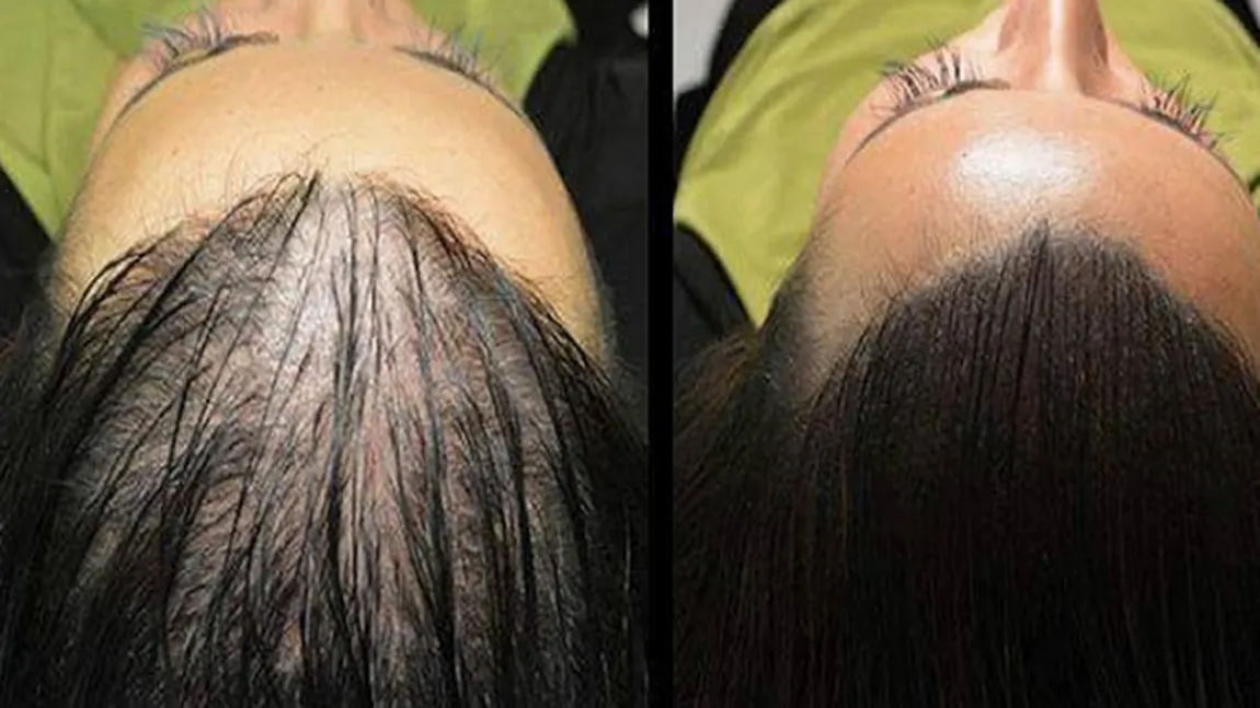 Reţeta magică pentru creşterea rapidă şi naturală a părului. Rezultate sunt ULUITOARE