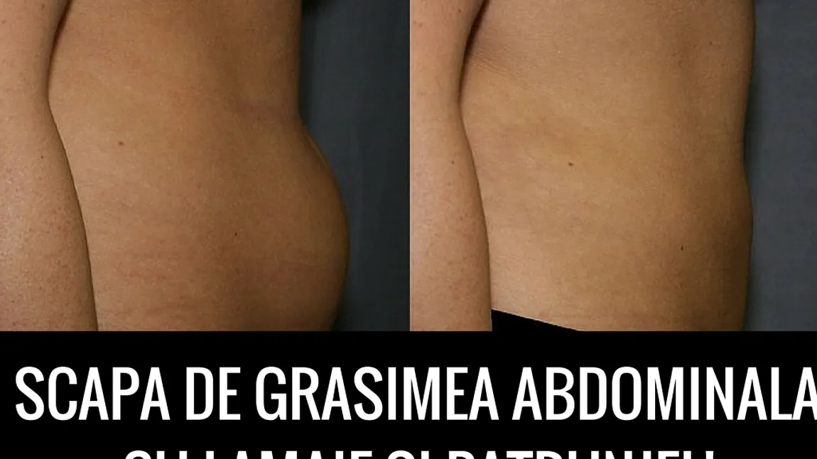 Scapă de grăsimea abdominală cu zeamă de lămaie şi pătrunjel!