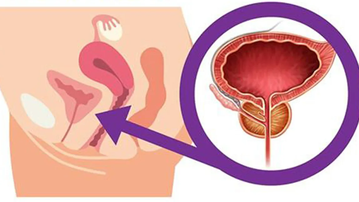 10 simptome ale cancerului ignorate de majoritatea femeilor