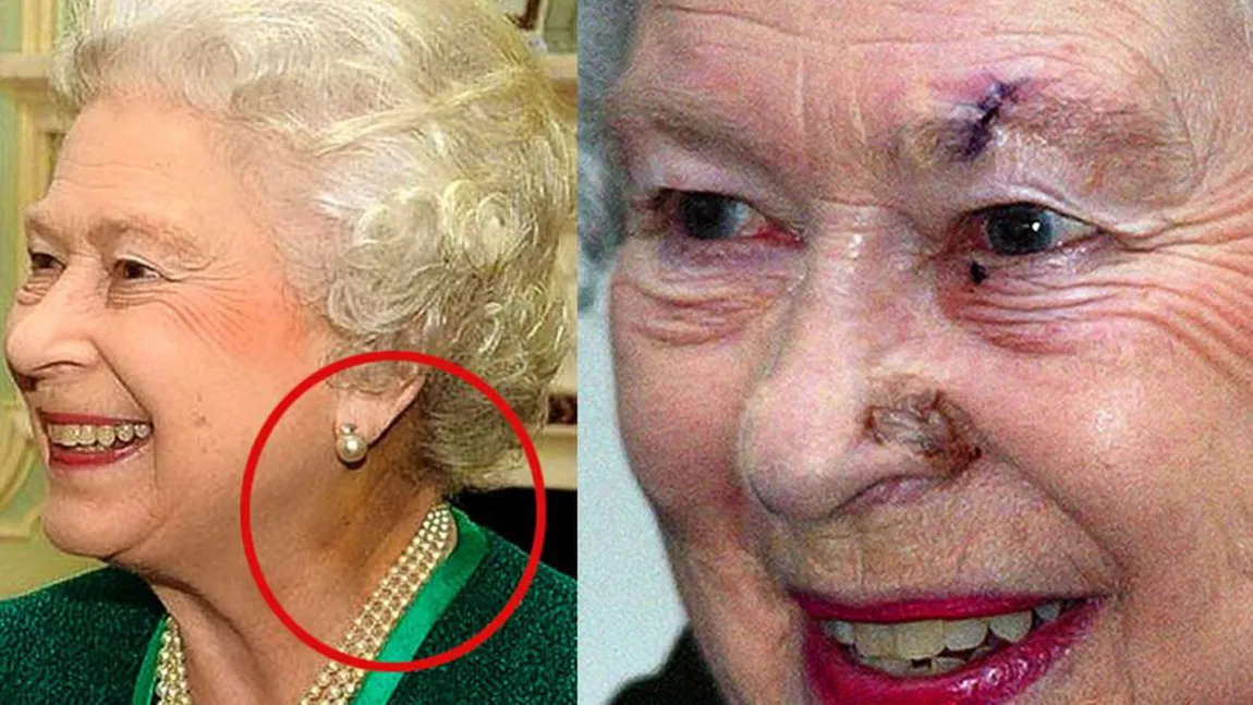 Ce a păţit Regina Elisabeta? IMAGINILE ŞOCANTE INTERZISE ÎN MAREA BRITANIE