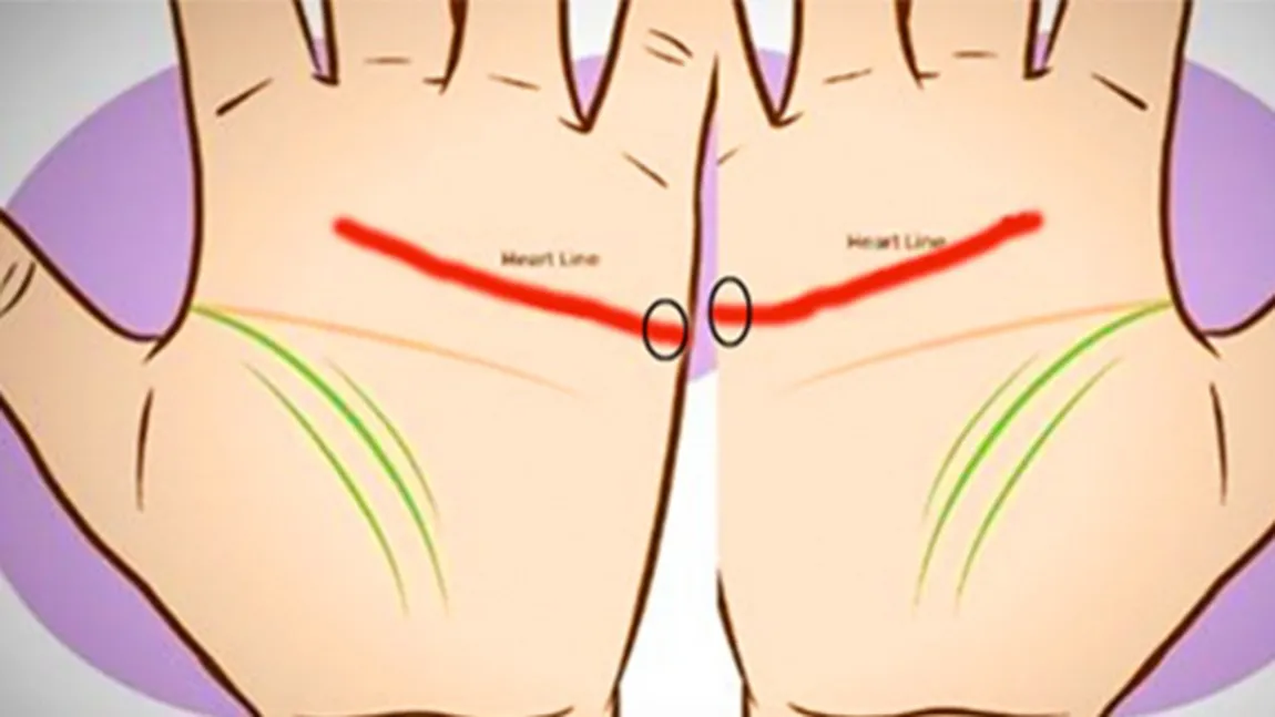 Uneşte-ţi palmele şi vezi dacă aceste linii se întâlnesc. Ce înseamnă de fapt