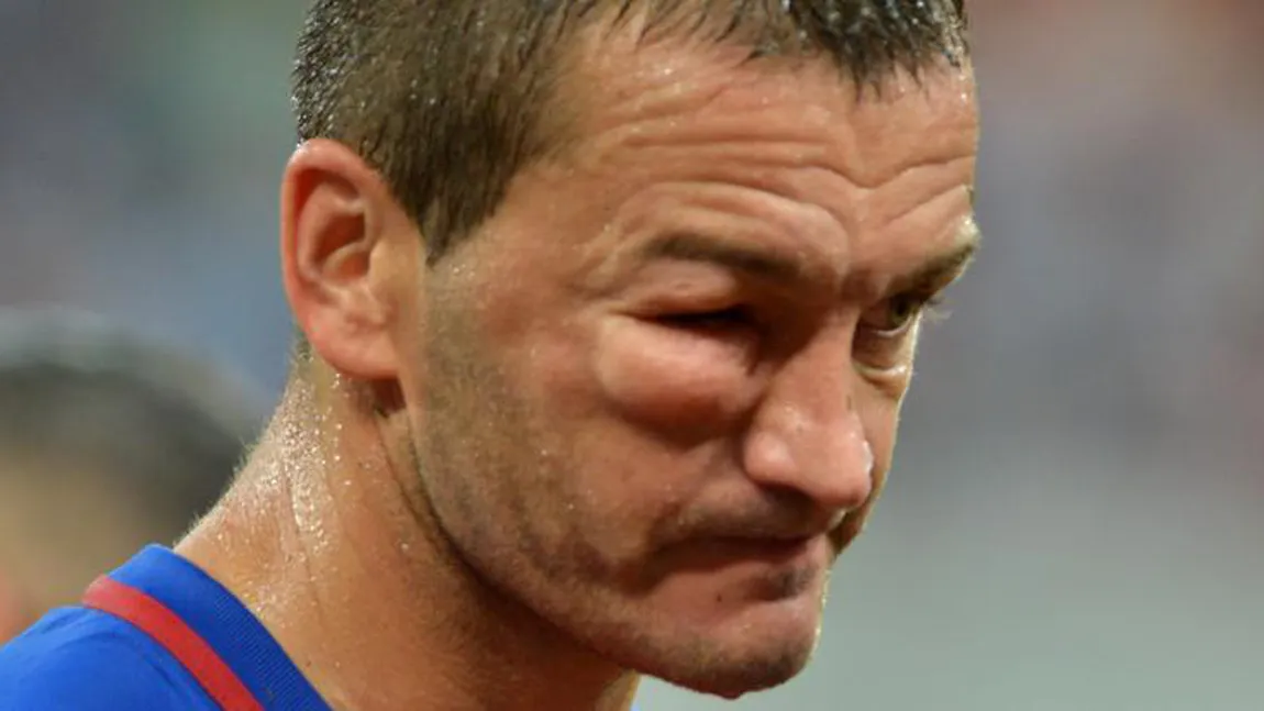 IMAGINI ŞOCANTE. Cum arată faţa tumefiată a lui Golubovic după meciul cu Manchester City FOTO