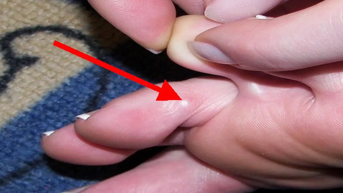 Priveşte cu atenţie zona dintre degetele de la picioare: asta îţi poate salva viaţa