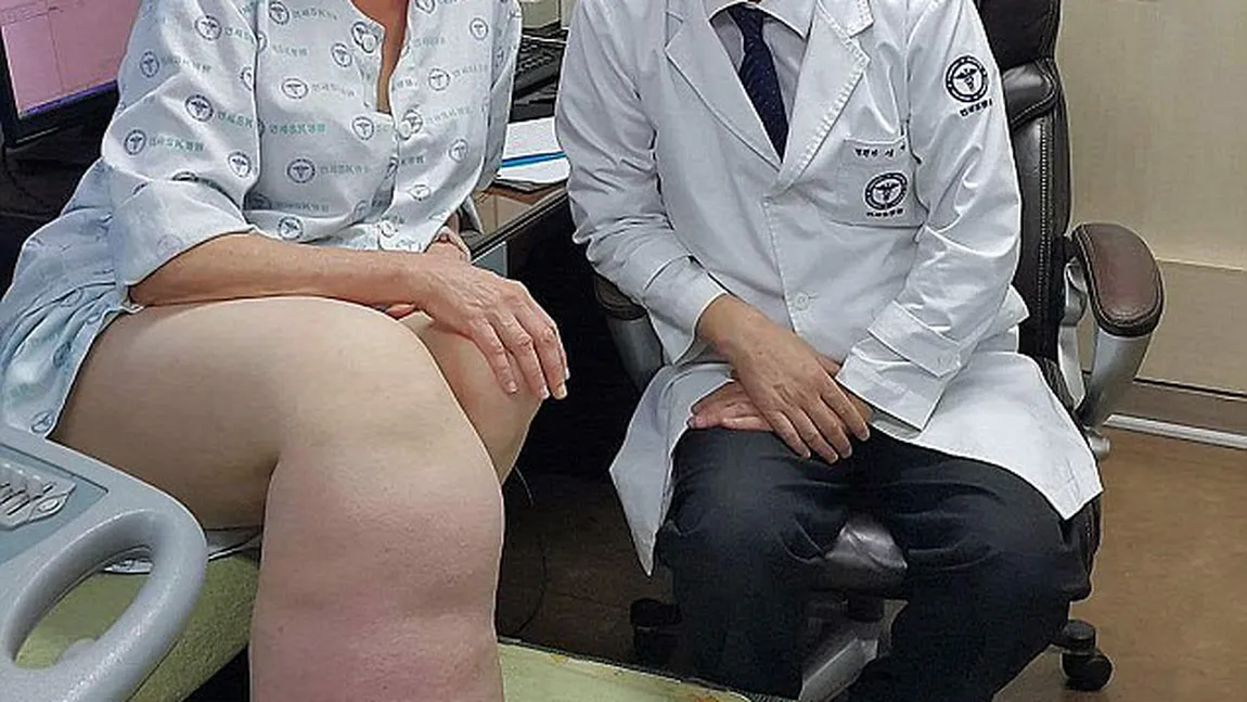 Femeia asta avea un picior de 5 ori mai gros şi mai mare decât celălalt. Ce au descoperit MEDICII