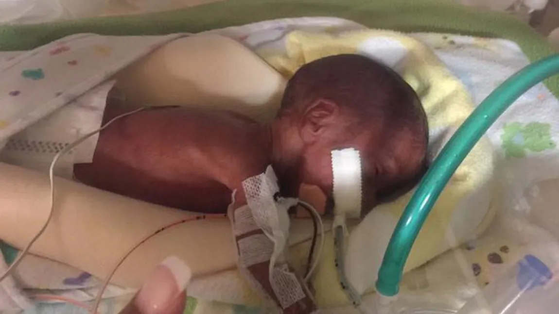Avea numai 425 de grame la naştere, iar medicii nu i-au dat nici măcar o şansă. E un miracol ce s-a întâmplat cu copilul