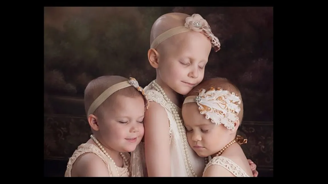 Şedinţa foto VIRALĂ a fetiţelor bolnave de CANCER, recreată. Cum arată cele trei după ce au ÎNVINS boala
