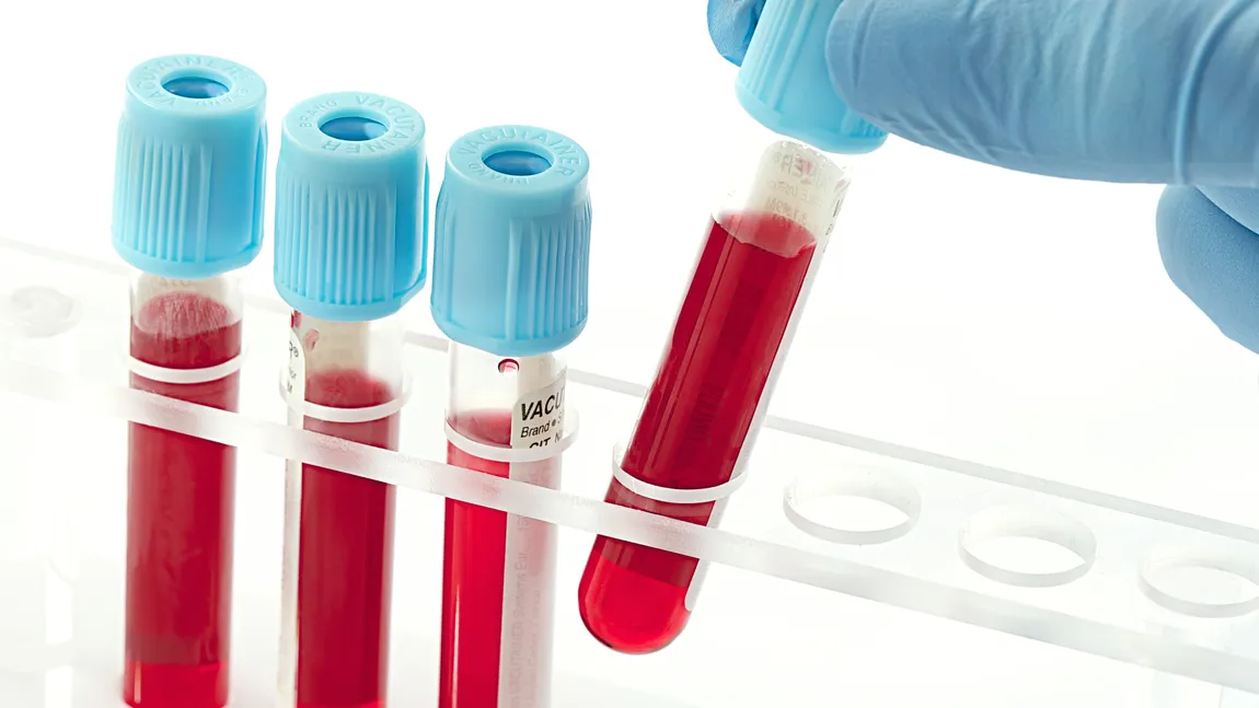 Un nou test de sânge poate depista tuberculoza în doar câteva ore