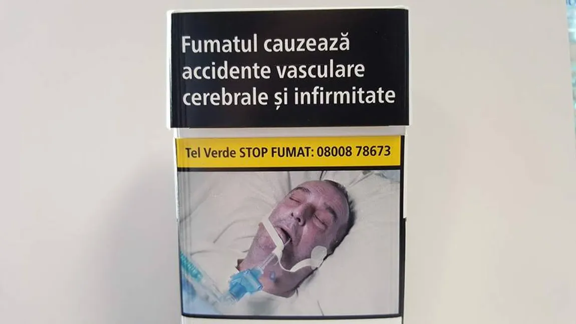 Scandal din cauza unei poze horror de pe un pachet de ţigări. Imaginea este a unui român care a murit în spital