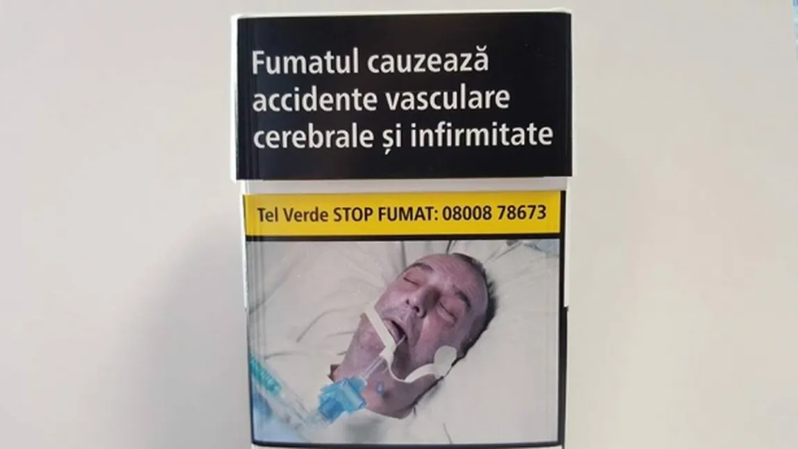 DETALII NOI în cazul românului a cărui fotografie apare pe pachetele de ţigări: Nu a fost intubat la spitalul din Cluj