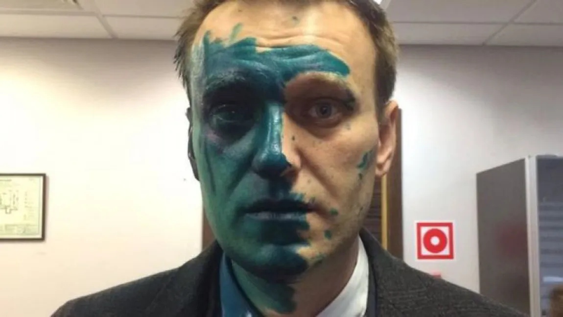 Liderul opoziţiei ruse, Aleksei Navalnîi, a ajuns la spital după ce a fost stropit cu vopsea antiseptică verde