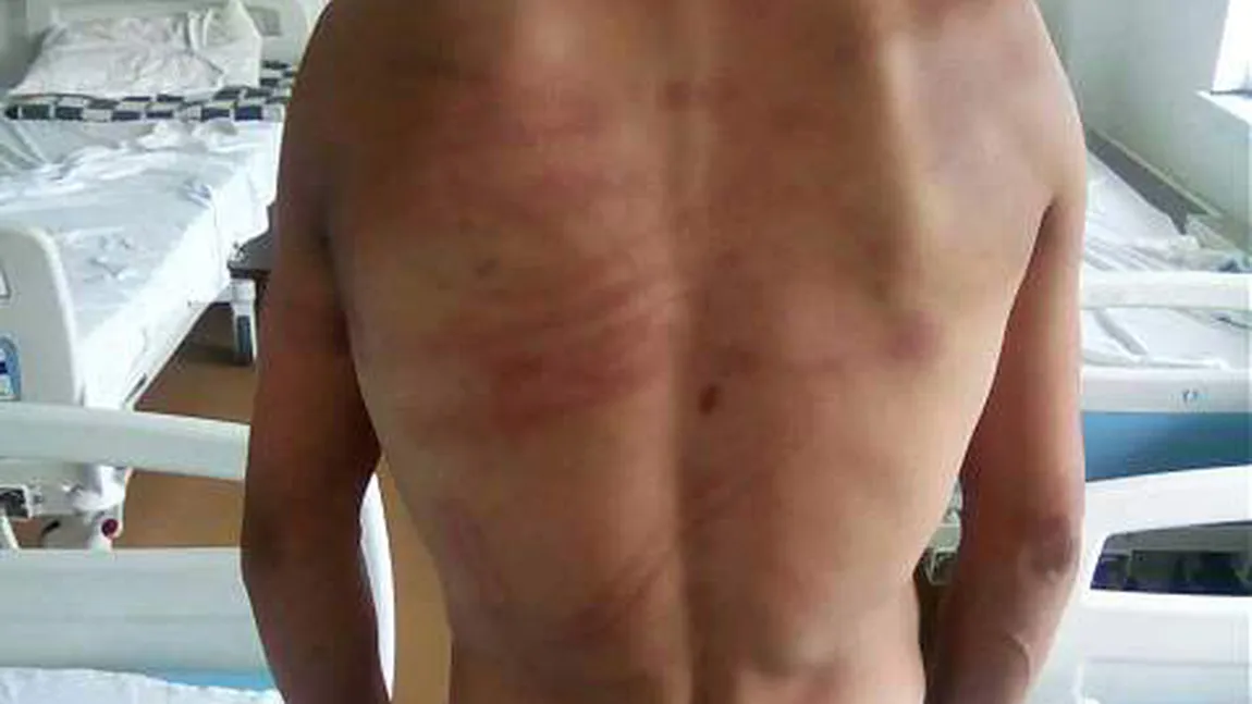 Un tânăr susţine că a fost bătut de 2 poliţişti din comuna COPĂLĂU. Acesta are 10 copci la gură şi este plin de vânătăi FOTO