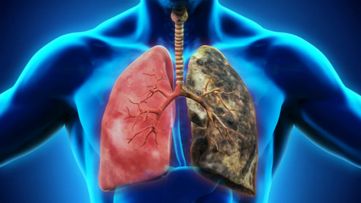 Fumatul regulat poate favoriza apariţia cancerului
