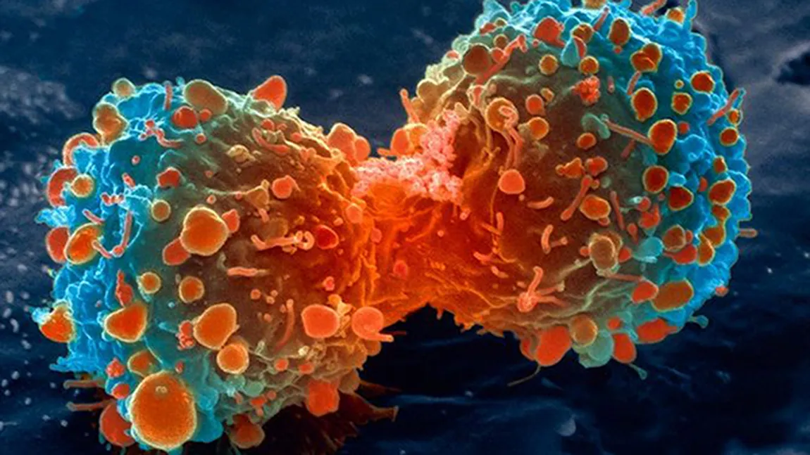 Medic: 40 la sută din oameni vor face CANCER
