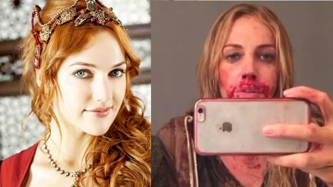 Meryem Uzerli (Sultana Hurrem), cu faţa plină de SÂNGE. Cum a ajuns să arate AŞA