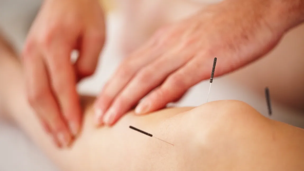 Scapă de durerile de genunchi şi recapătă-ţi mobilitatea cu ajutorul acupuncturii