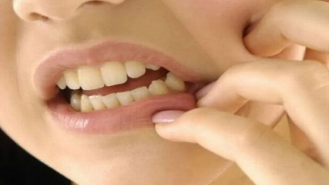 Simptome dentare pe care nu trebuie să le ignori