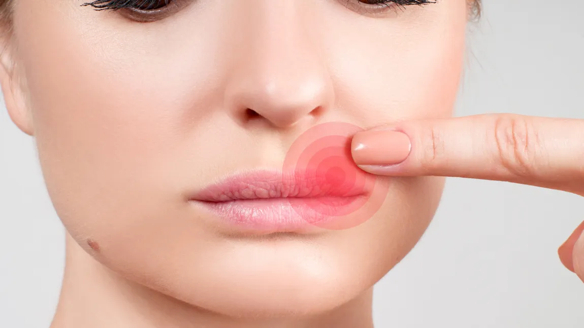 Adevărat sau fals despre herpes