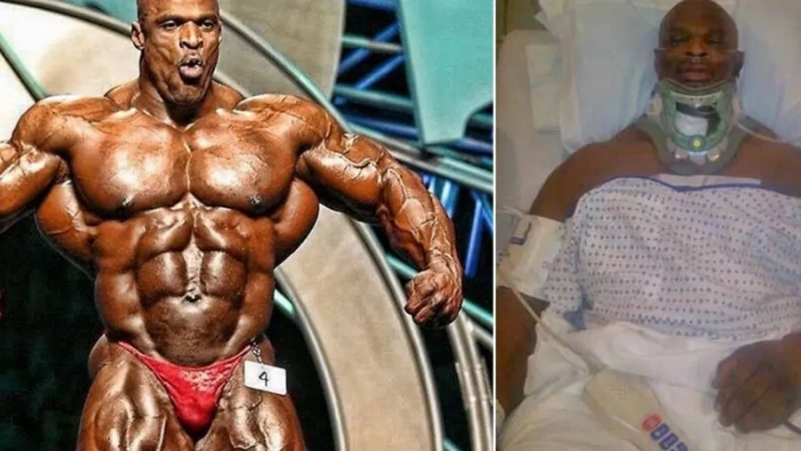 Drama prin care trece Ronnie Coleman. A plătit 2.000.000 de dolari pentru operaţii, dar risca sa rămână paralizat FOTO