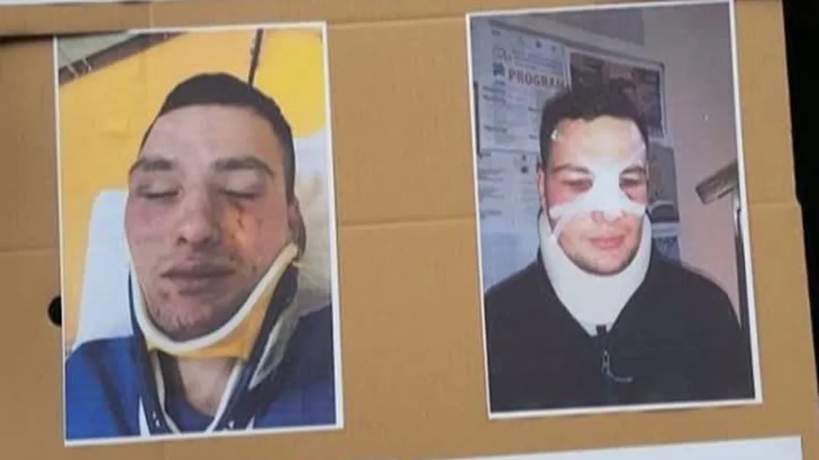 Primele imagini cu poliţistul bătut de patronul unei pensiunui din Harghita