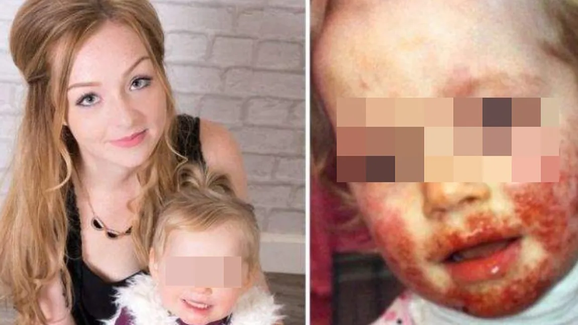 Caz şocant de sărut al morţii! A fost la un pas să piară, după un pupic nevinovat: Mamelor, nu mai permiteți să vi se pupe copilașii