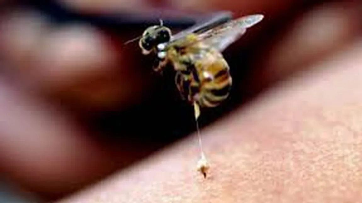 Intepaturile de albine si viespi la copii. Ce faci imediat după înţepătură