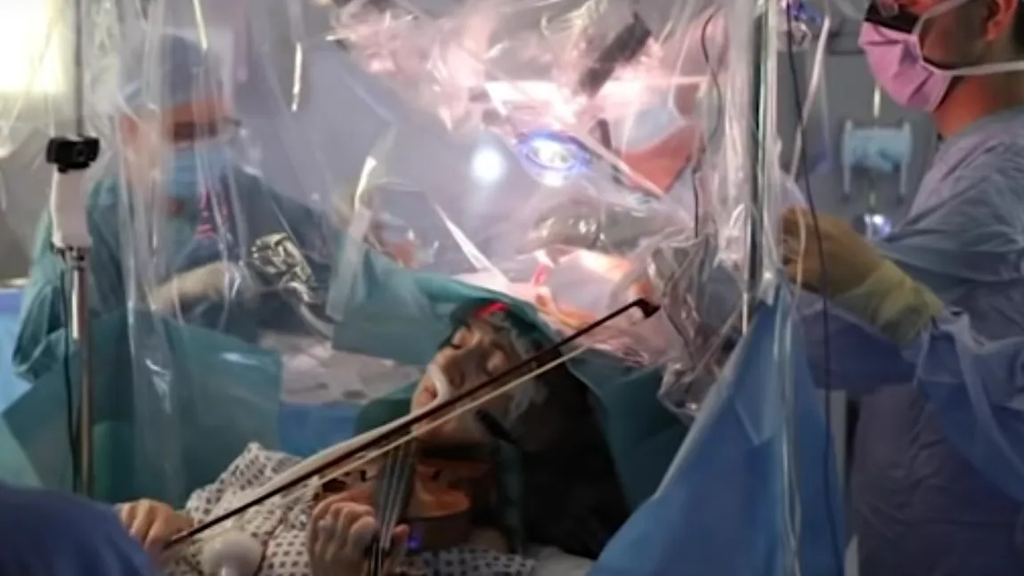 Imagini incredibile! O femeie cântă la vioară în timp ce medicii o operau pe creier VIDEO