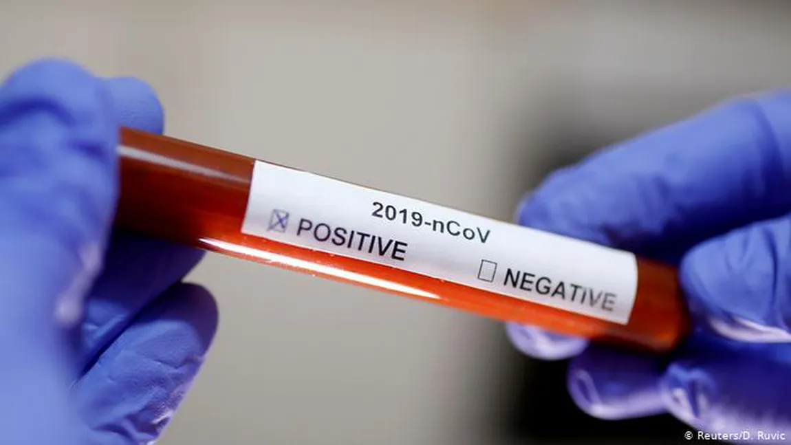 Clinicile private din România au început să facă teste pentru depistarea anticorpilor COVID-19