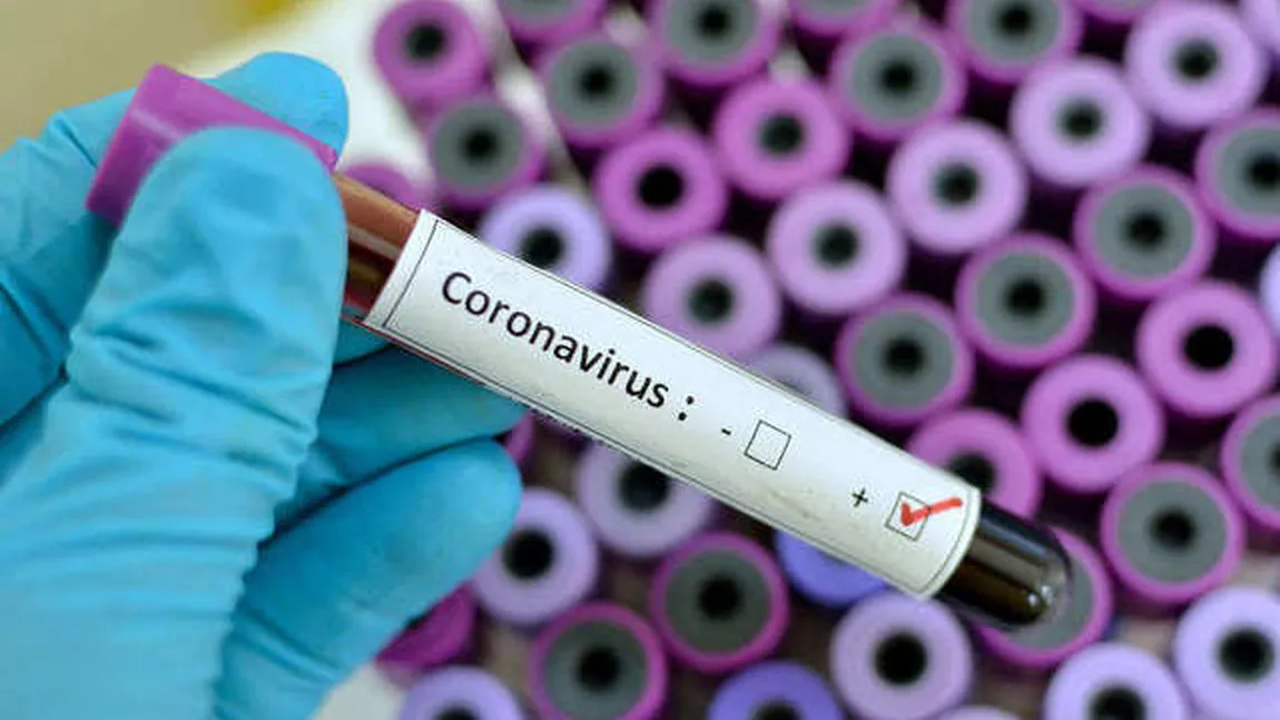 BILANŢ CORONAVIRUS ROMÂNIA 15 APRILIE. Aproape 340 de noi cazuri de coronavirus în 24 de ore. Numărul total a ajuns la 7.216