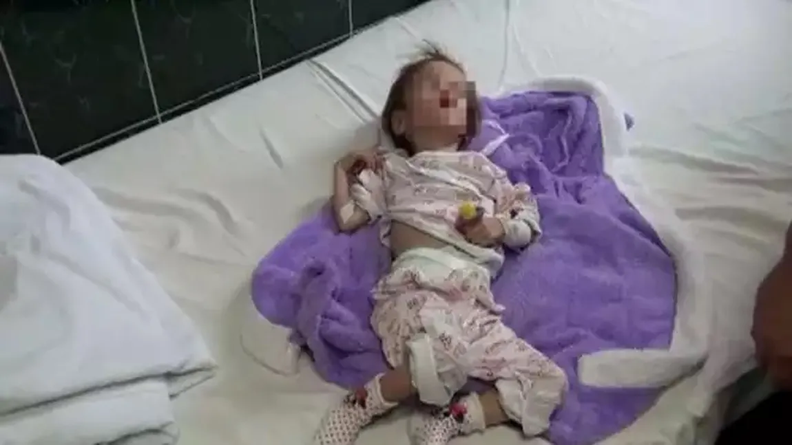 Cum arată fetiţa hrănită până la 4 ani doar cu ceai şi pufuleţi. Florentina a fost adoptată de o familie cu suflet mare