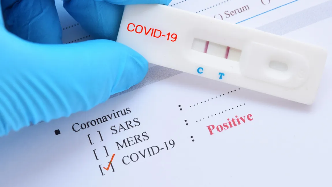 Bilanţ COVID-19 la 22 iulie în România. 372 de pacienţi pozitivi cu coronavirus în urma retestării
